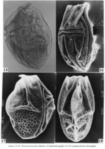 Ploesoma lenticulare