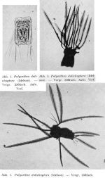 Polyarthra dolichoptera