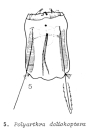 Polyarthra dolichoptera