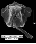 Polyarthra dolichoptera