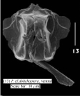 Polyarthra dolichoptera