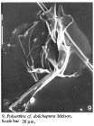 Polyarthra dolichoptera