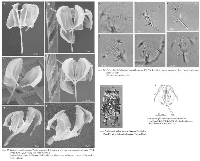 Polyarthra dolichoptera Polyarthra dolichoptera