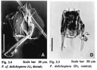 Polyarthra dolichoptera