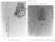 Polyarthra dolichoptera