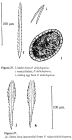 Polyarthra dolichoptera