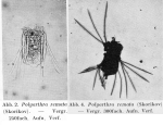 Polyarthra remata