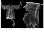 Polyarthra vulgaris