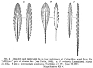 Polyarthra vulgaris