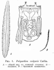 Polyarthra vulgaris