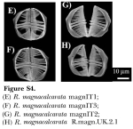 Rotaria magnacalcarata