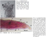 Rotaria neptunoida