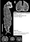 Rotaria tardigrada