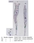 Rotifer vulgaris