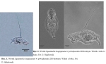 Squatinella longispinata