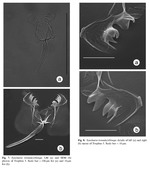 Synchaeta tremula