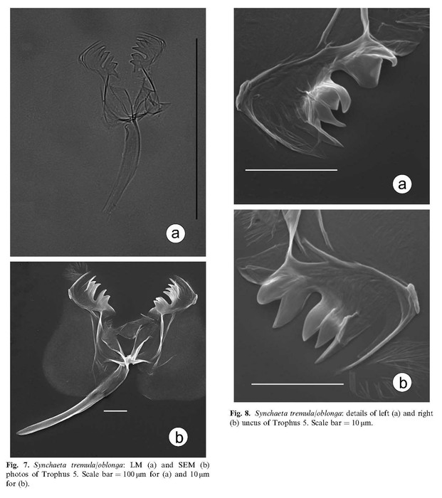 Synchaeta tremula Synchaeta tremula