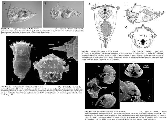 Synchaeta tremula Synchaeta tremula