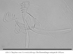Synchaeta tremula