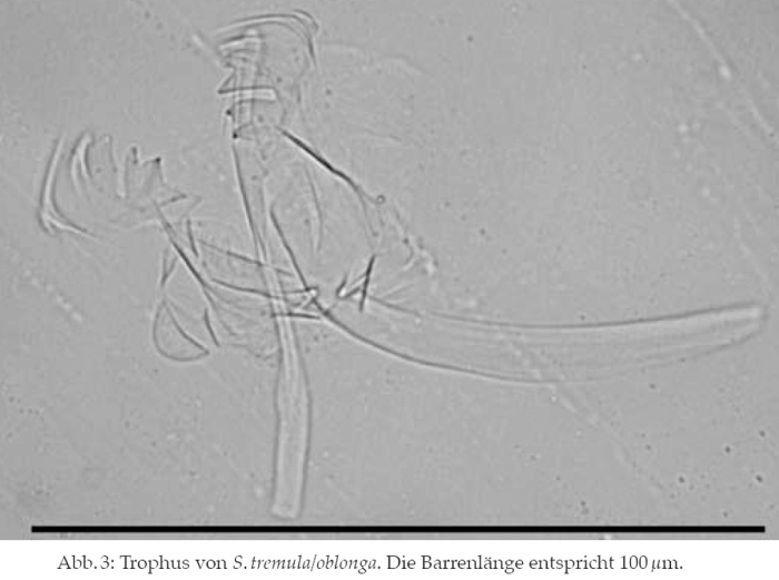 Synchaeta tremula Synchaeta tremula
