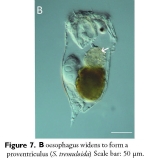 Synchaeta tremuloida