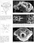 Synchaeta triophthalma
