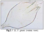 Testudinella greeni