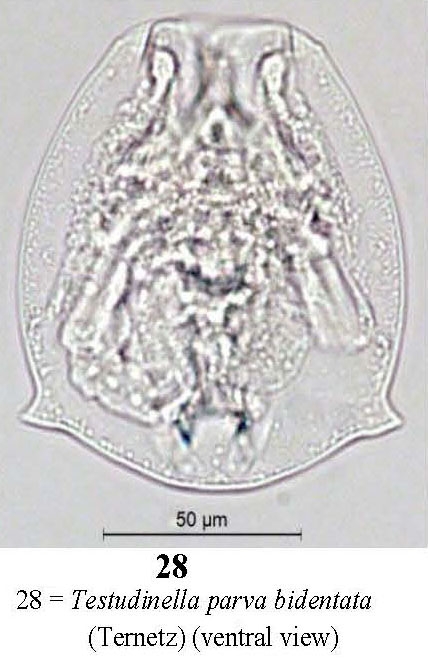Testudinella parva f. bidentata Testudinella parva f. bidentata