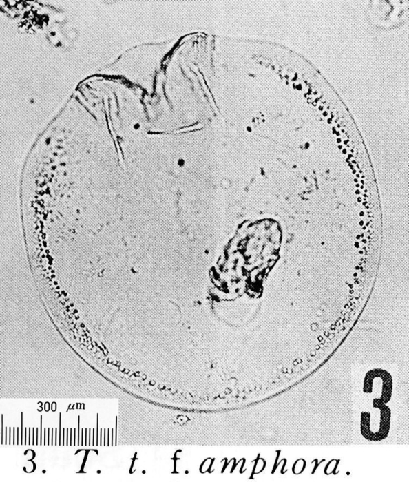 Testudinella trilobata f. amphora Testudinella trilobata f. amphora