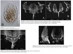 Testudinella zhujiangensis