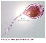 Trichocerca flagellata