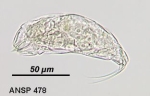 Trichocerca montana
