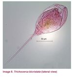 Trichocerca rattus f. carinata