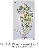 Trichocerca simoneae