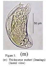 Trichocerca weberi