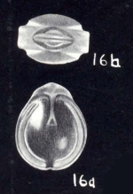 Fissurina crassiformis McCulloch, 1981