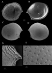 Thaumatoconcha quasiporosa Karanovic & Brandão, 2011 from the original description