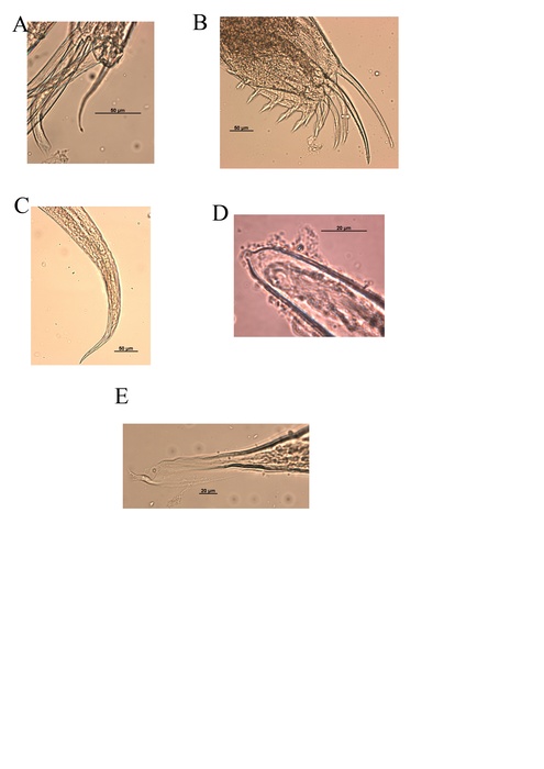 Thaumatoconcha quasiporosa Karanovic &amp; Brandão, 2011 from the original description