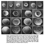 Thaumatoconcha radiata Kornicker & Sohn, 1976 from the original description