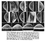Thaumatoconcha radiata Kornicker & Sohn, 1976 from the original description