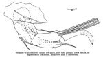 Thaumatoconcha radiata Kornicker & Sohn, 1976 from the original description