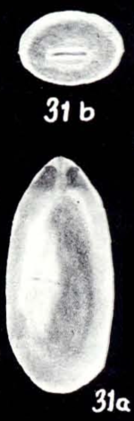 Fissurina labiosiformis McCulloch, 1981
