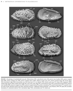 Some morphological characters of Trachyleberididae