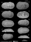 Lectotype, Paralectotypes and additional specimens from Cythere dasyderma Brady, 1880