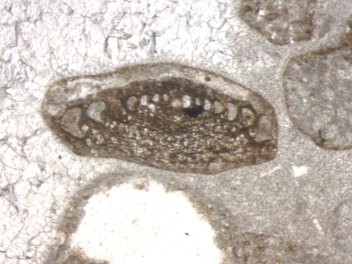 Hensonipapillus cantabricus Schlagintweit, Rigaud &amp; Wilmsen, 2015 holotype