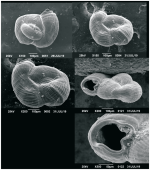 Neopateorislopsis chichirivensis Carvajal-Chitty, 2019