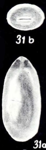 Marginulina augensiformis McCulloch, 1981