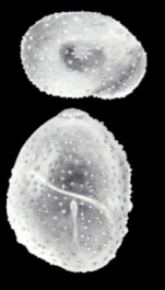 Globulina leishensis McCulloch, 1981