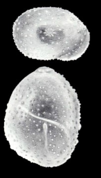 Globulina leishensis McCulloch, 1981