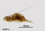 Squatinella longispinata
